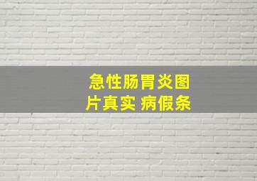 急性肠胃炎图片真实 病假条